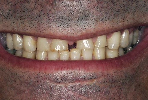 toothache photo