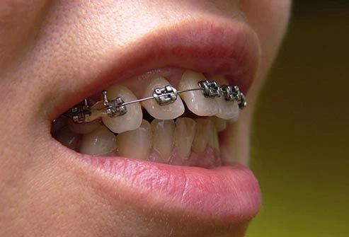 toothache photo