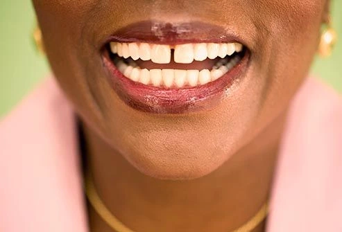 toothache photo