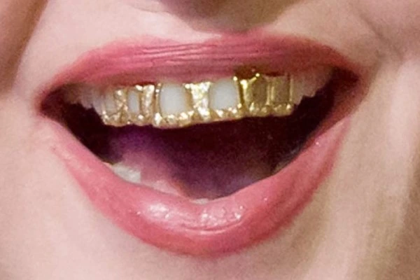 toothache photo
