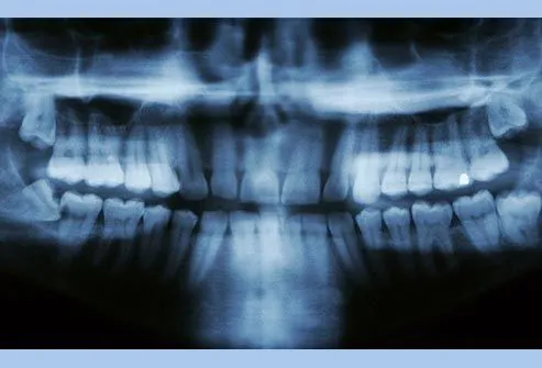 toothache photo